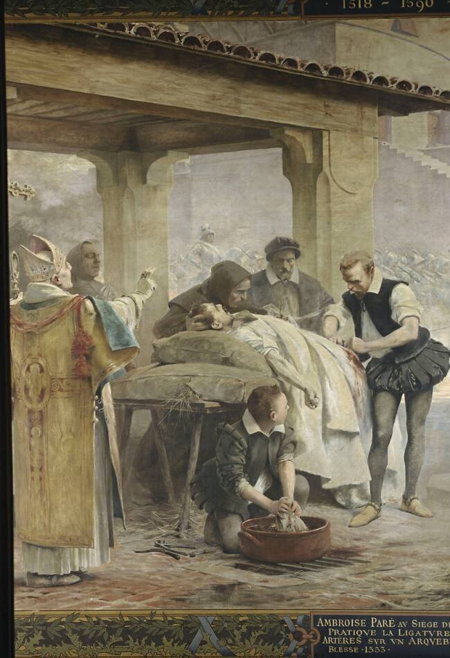 Ambroise Paré pratique la ligature des artères Théobald Chartran