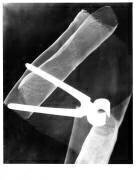 Photogramme avec une pince (Eliezer Lissitzky) - Muzeo.com
